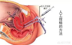 二代试管婴儿机构_遵循备孕规则，孕育一个聪明的宝宝。